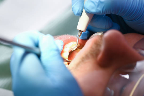 Best Holiday Emergency Dentist in New Franklin, OH