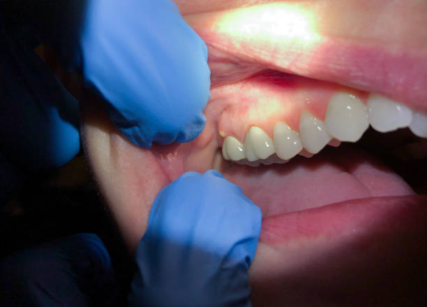 Best Mobile Emergency Dentist in New Franklin, OH